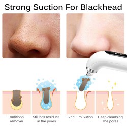 Oxygenation Cleanser Beauty Electric Blackhead Suction Instrument