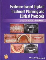 Evidence-based Implant Treatment Planning and Clinical Protocols