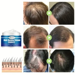 Biotin Keratin Hair Renew Cream - Essential Hair Care Oil for Women and Men, Penetrates from Root to Tip for Healthy Hair