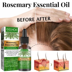 Rosemary Hair Care Essential Oil Anti-loss