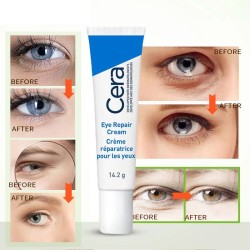 Retinol Anti-wrinkle Eye Cream - Removes Dark Circles, Eye Bags, and Puffiness