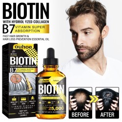 Biotin Fast Oil Hair Regrowth Serum - Anti-Hair Loss Treatment for Hair Thinning