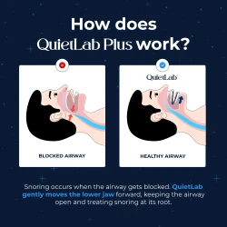 QuietLab® Adjustable Anti-Snoring Mouthpiece