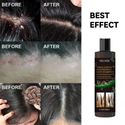 Oil Control Anti-itching Shampoo Deep Cleaning