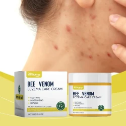 Bee Venom Eczema Care Cream - Soothing & Moisturizing Relief for All Skin Types